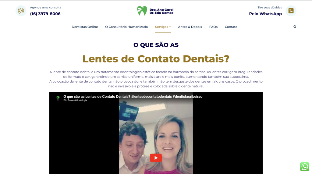 Lentes de Contato Dental | Dr. Edu Gomes
